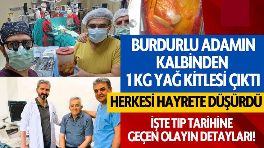 Burdurlu Adamın kalbinden 1 kg yağ kitlesi çıktı; herkesi hayrete düşürdü